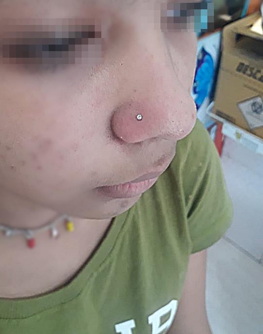 Nostril (Nariz)
